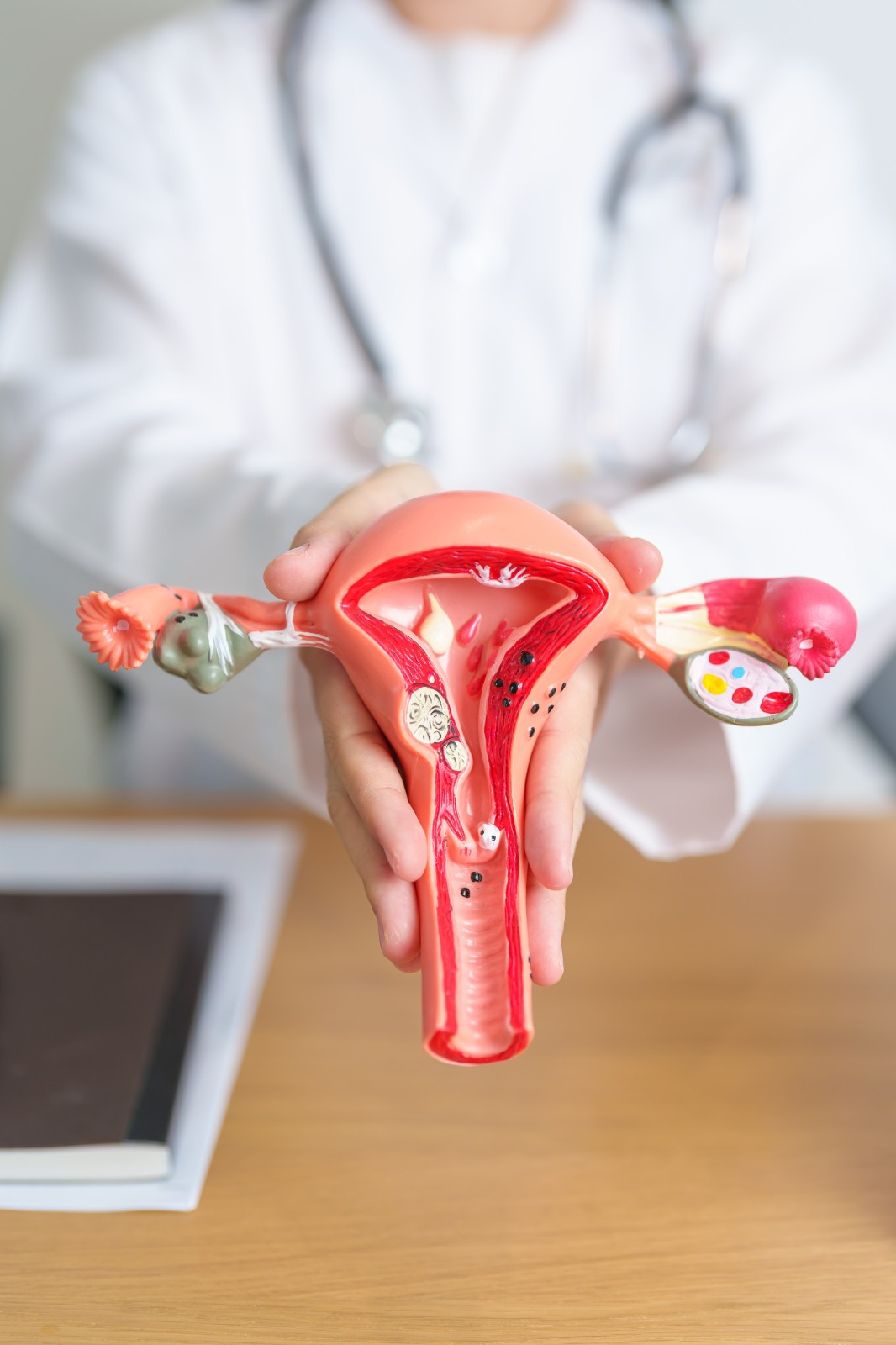 VPH: vacuna clave contra el cáncer cervical