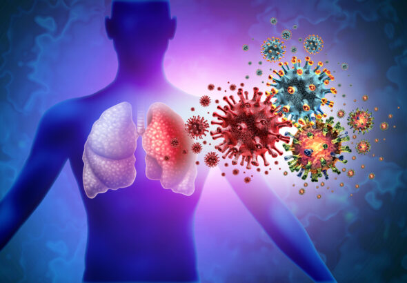 Triple Virus Lung Infection